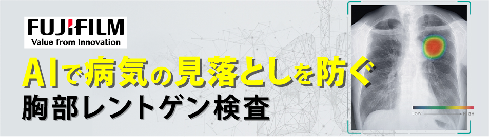 AIで病気の見落としを防ぐ胸部レントゲン検査